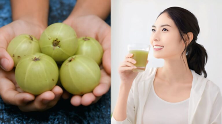 Amla